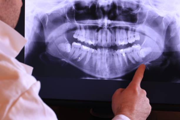 Best Emergency Dental Services for Seniors in Mechanicsville, VA