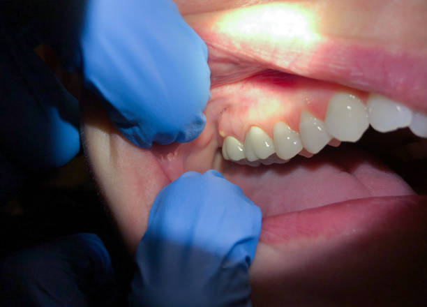Best Urgent Dental Care for Toothache in Mechanicsville, VA