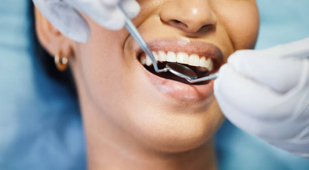 Best Emergency Dental Extractions in Mechanicsville, VA